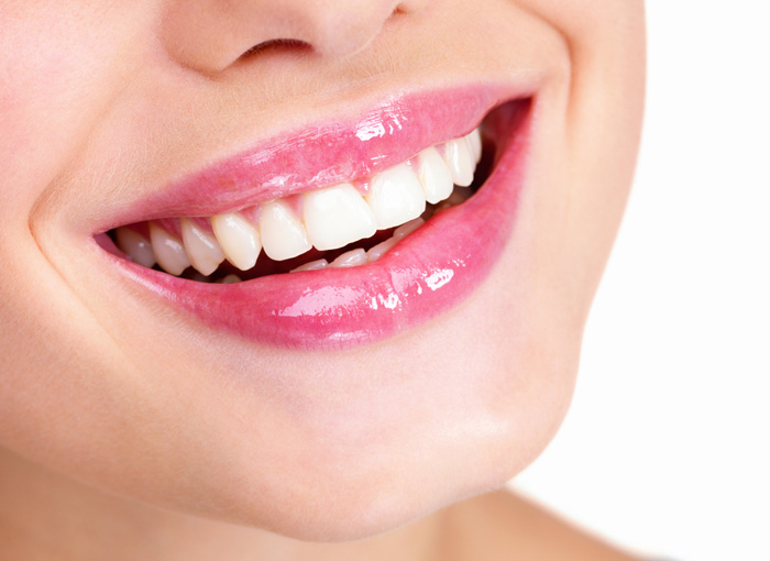 Dental Veneers in Vancouver WA