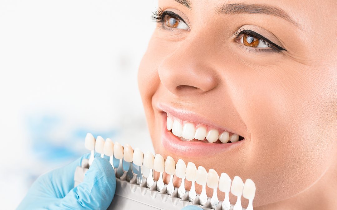 DIY Teeth Whitening Trends: Fact or Fiction?